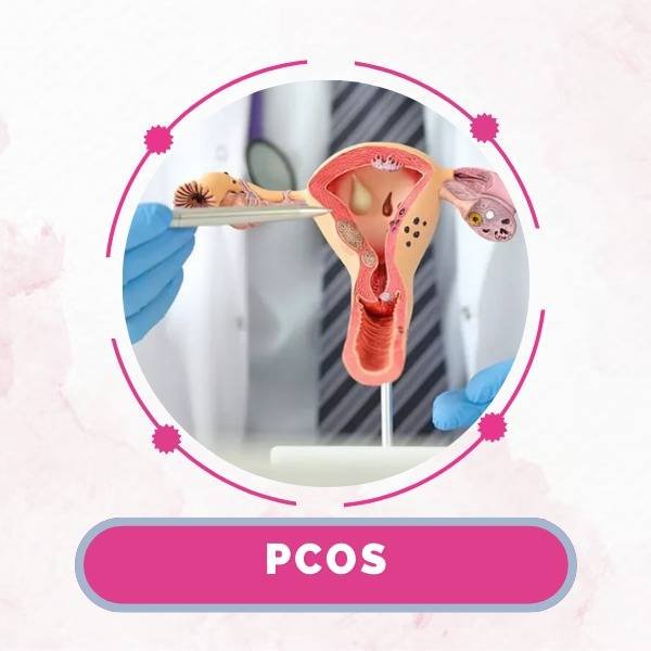 PCOS at Jivika Gynae Clinic