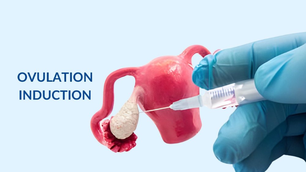 Ovulation induction procedure involving a syringe and ovary model