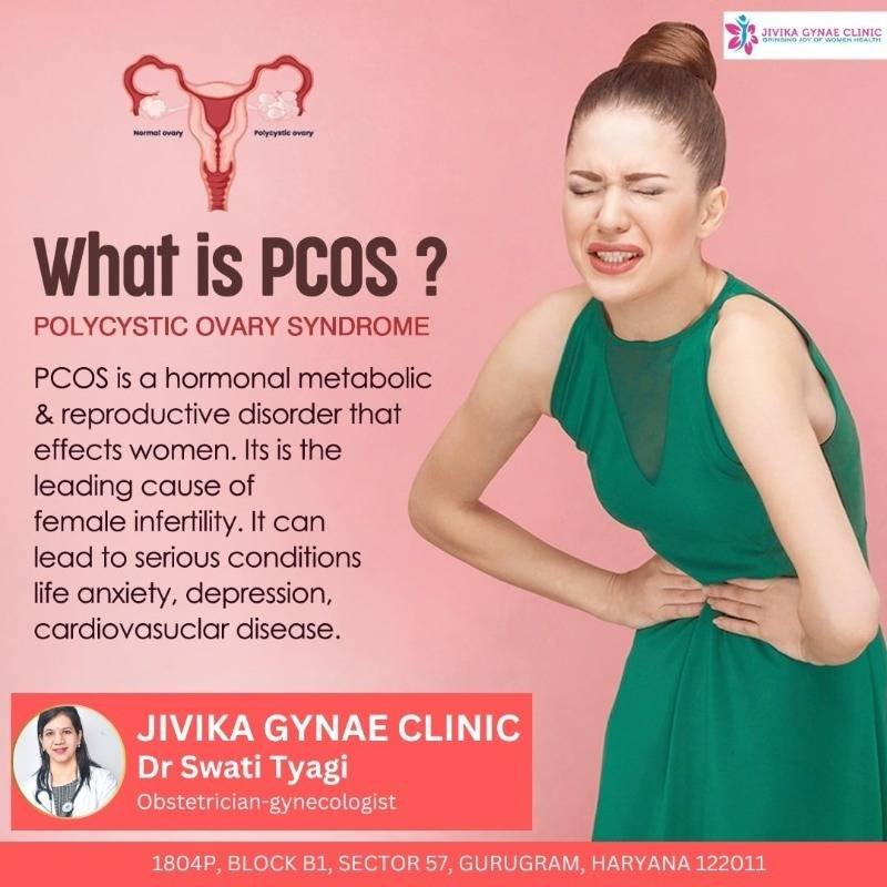 Informative graphic on PCOS from Jivika Gynae Clinic, featuring Dr. Swati Tyagi and an image of a woman in discomfort holding her lower abdomen.